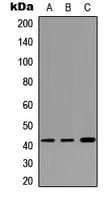 Polyclonal Rabbit anti-Human CTSW / Cathepsin W Antibody (Internal, WB)