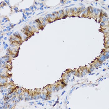 NAA10 / ARD1A Antibody