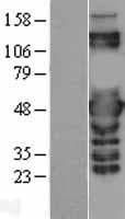 PSMC3 Protein (Over-Expression Lysate Myc-DDK (Flag))