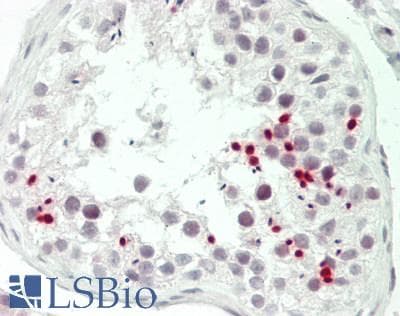 IHC-plus™ Polyclonal Rabbit anti-Human GATA5 Antibody (aa260-313, IHC, WB)