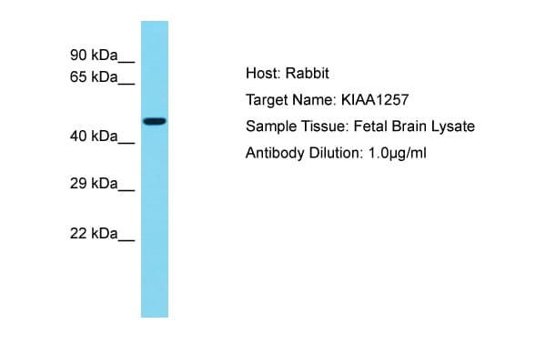 KIAA1257 Antibody (aa314-363)