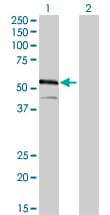 IHC-plus™ IRF4 Antibody (clone 2F2)