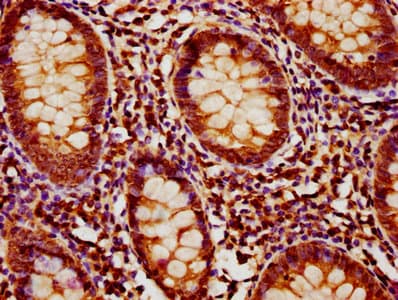 Polyclonal Rabbit anti-Human MOB1B / MOBKL1A Antibody (aa2-216, WB)