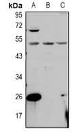 Polyclonal Rabbit anti-Human PPM1L Antibody (WB)