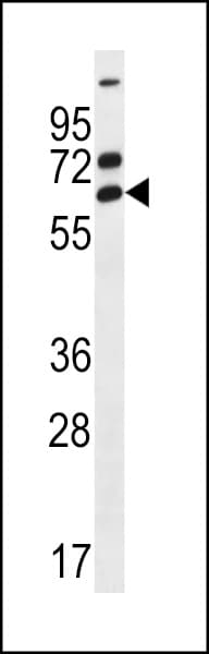 ZNF835 Antibody (aa4-33)
