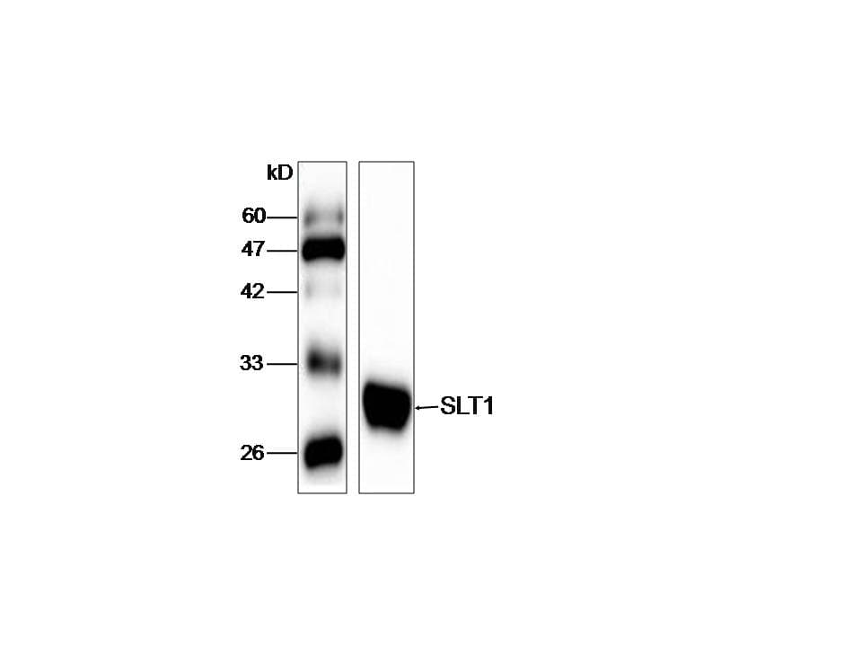 Shiga-Like Toxin 1 Subunit A Antibody (aa17-244)