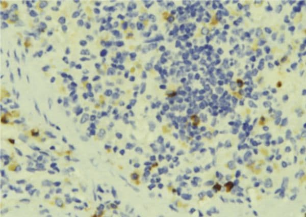 STOML2 Antibody