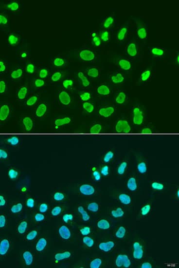 CBX5 / HP1 Alpha Antibody