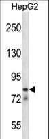 Polyclonal Rabbit anti-Human CATSPER1 / CATSPER Antibody (aa36-65, WB)