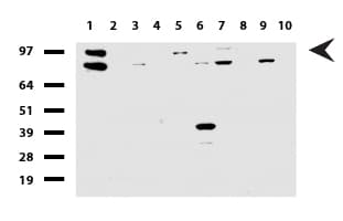 CDH2 / N Cadherin Antibody (clone UMAB23, Carrier-free)