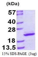 Human MRLC2 / MYL12B Protein (Recombinant His)