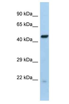 RFX6 Antibody (aa181-230)