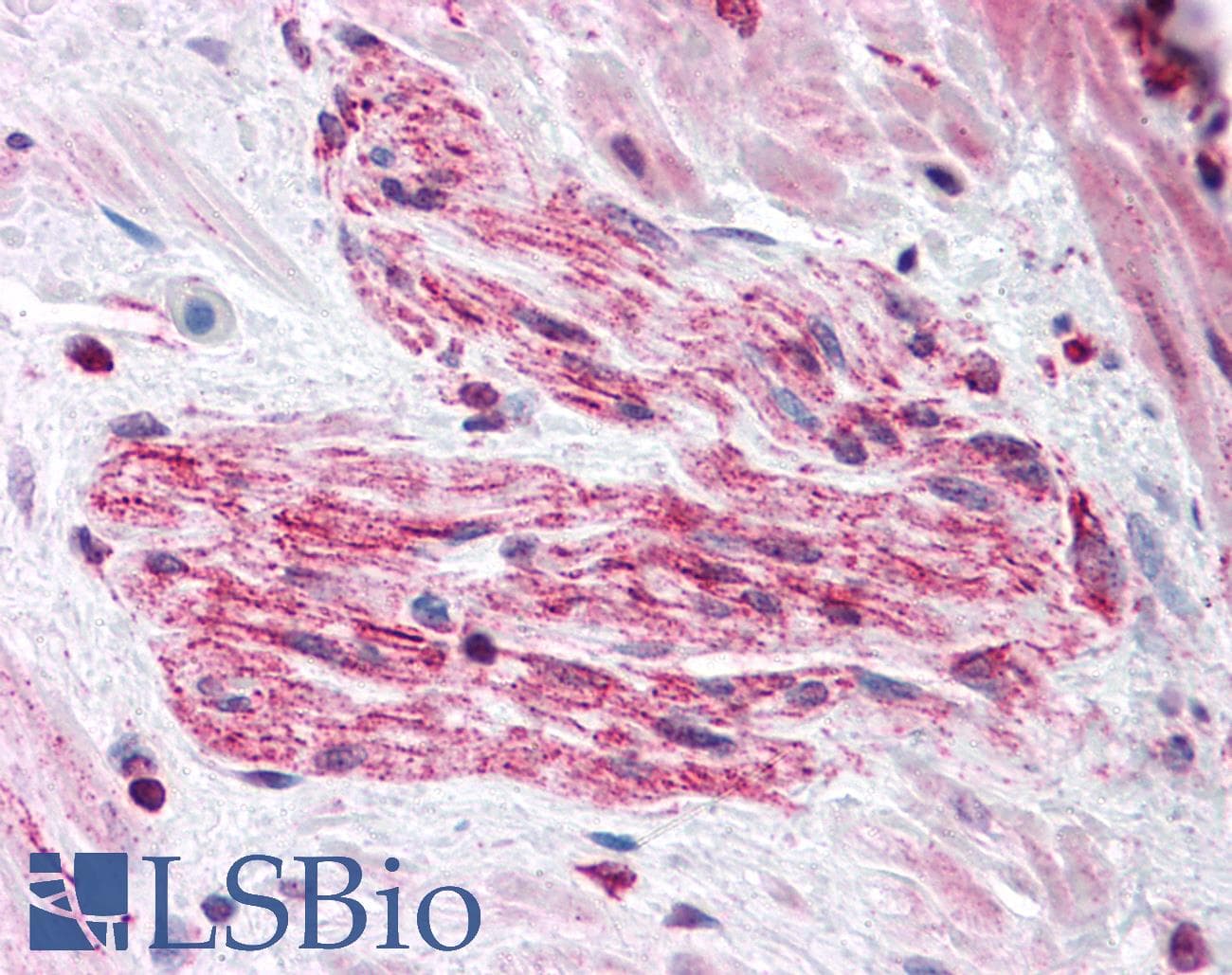 IHC-plus™ RUSC2 Antibody