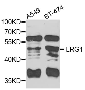 IHC-plus™ Polyclonal Rabbit anti-Human LRG1 / LRG Antibody (IHC, WB)