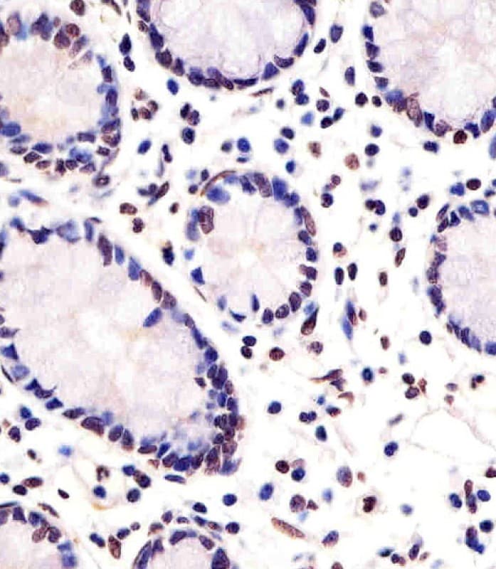 FEV / PET1 Antibody (aa17-49)
