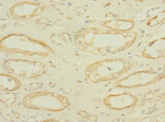 SLC36A2 Antibody