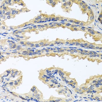 OSM / Oncostatin M Antibody