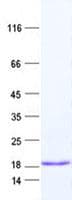 Human RPS23 / Ribosomal Protein S23 (Recombinant His, N-Terminal)