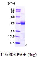 Human KRAS Protein (Recombinant His)