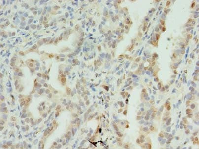 SDHC Antibody