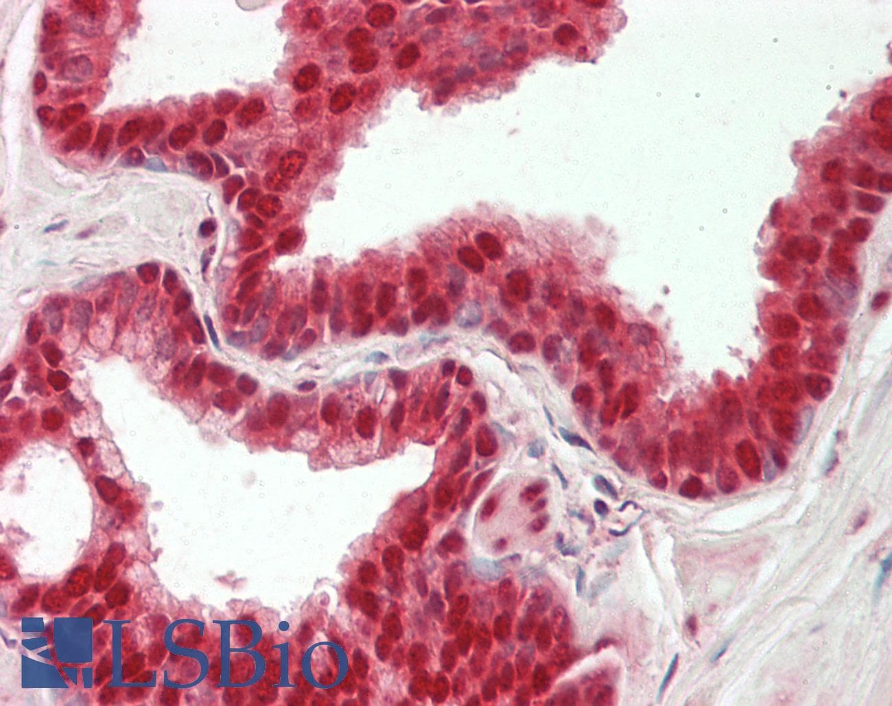 Polyclonal Rabbit anti-Human HNRNPL / hnRNP L Antibody (aa82-131, IHC, WB)