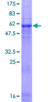 Human RCBTB1 Protein (Recombinant GST)