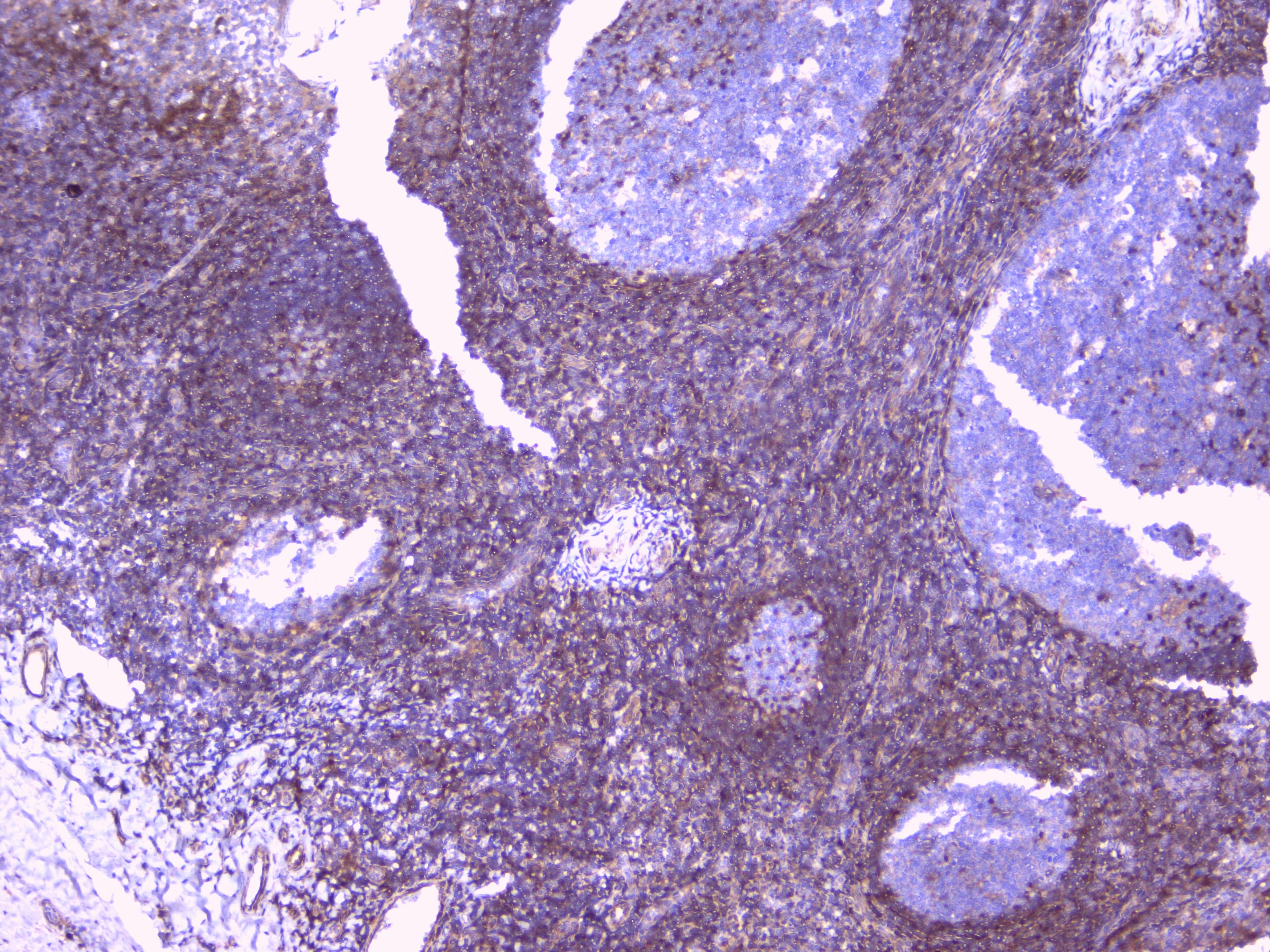 Polyclonal Rabbit anti-Human PEBP1 / RKIP Antibody (WB)