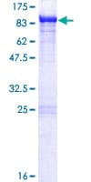 Human KLC2 Protein (Recombinant GST)