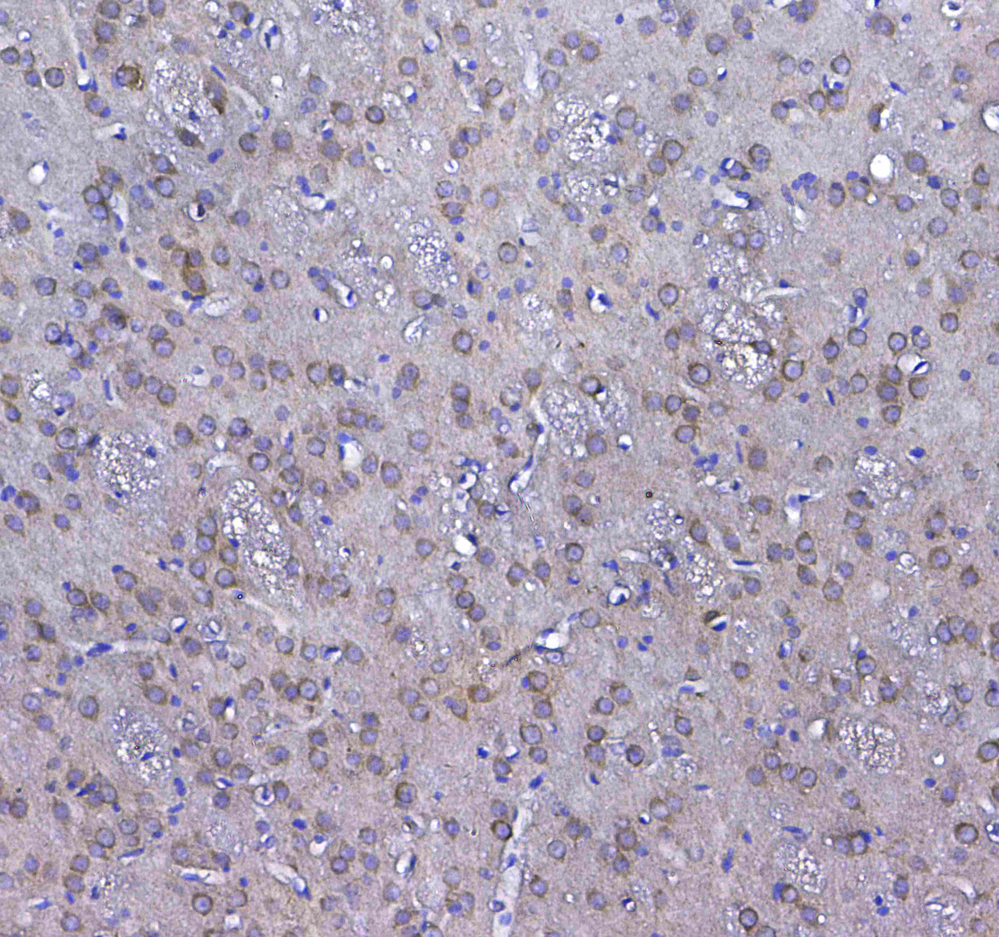 GSTM3 Antibody