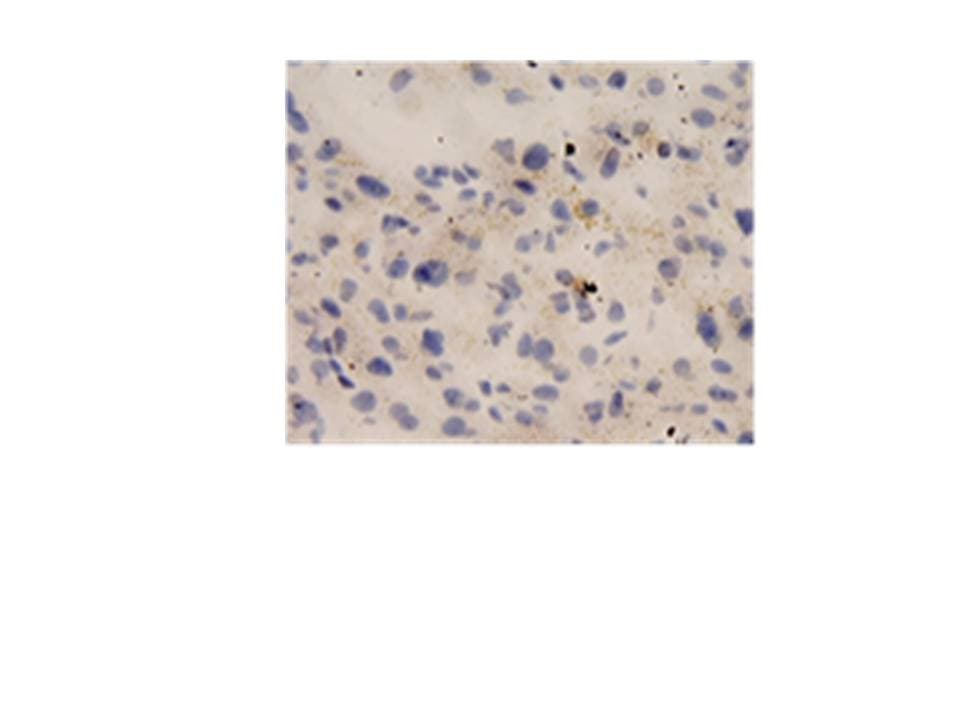 Monoclonal Mouse anti-Human IL18 Antibody (clone 50008-2, IHC, WB)