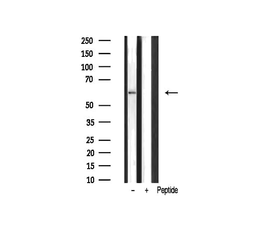 Polyclonal Rabbit anti-Human UBXN11 / SOC Antibody (IHC, IF, WB)