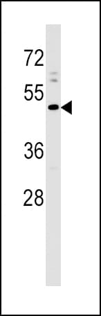 PRLHR / GPR10 Antibody (aa284-312)