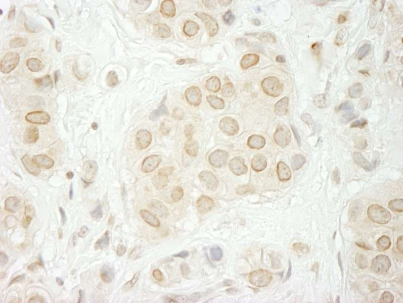 Polyclonal Rabbit anti-Human TOR1AIP1 / LAP1 Antibody (aa275-325, IHC)