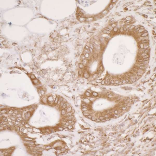 PDIA3 / ERp57 Antibody (aa25-75)
