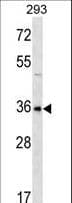 GBX1 Antibody (aa118-147)