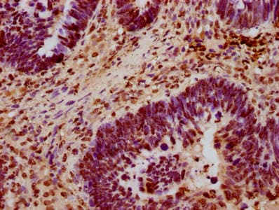 Polyclonal Rabbit anti-Human HIST1H3A Antibody (IHC)