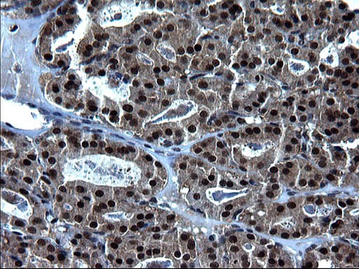 ZFAND3 / TEX27 Antibody (clone OTI1H10)