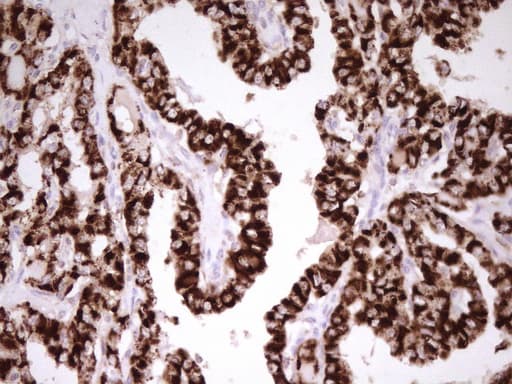 ABAT Antibody (aa29-323, clone UMAB178, Carrier-free)