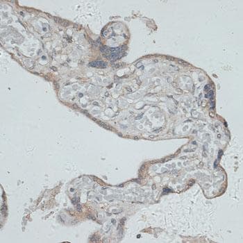 Polyclonal Rabbit anti-Human GMPR1 / GMPR Antibody (IHC)