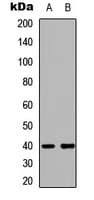 LMTK3 Antibody (C-Terminus)