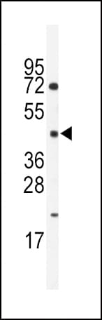 HNF4G / HNF4 Gamma Antibody (aa258-287)