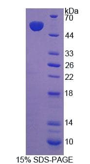 Rabbit HGF / Hepatocyte Growth Factor Protein (Recombinant His-T7)