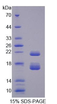 Mouse CBY1 / PGEA1 Protein (Recombinant)