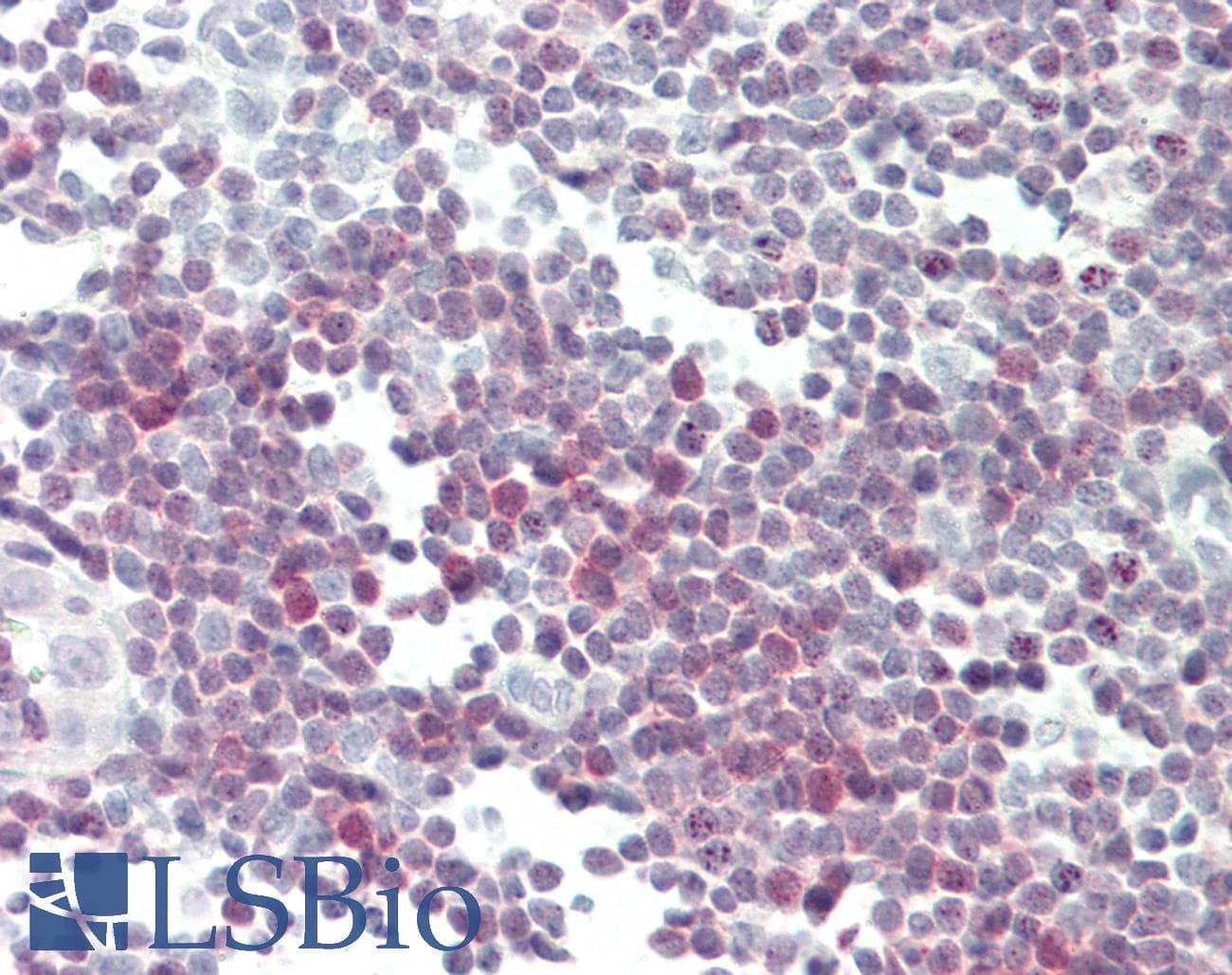 IHC-plus™ GIMAP4 Antibody (clone 1C6)