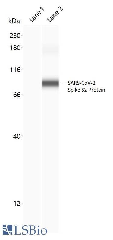 SARS-CoV-2 Spike Glycoprotein Antibody