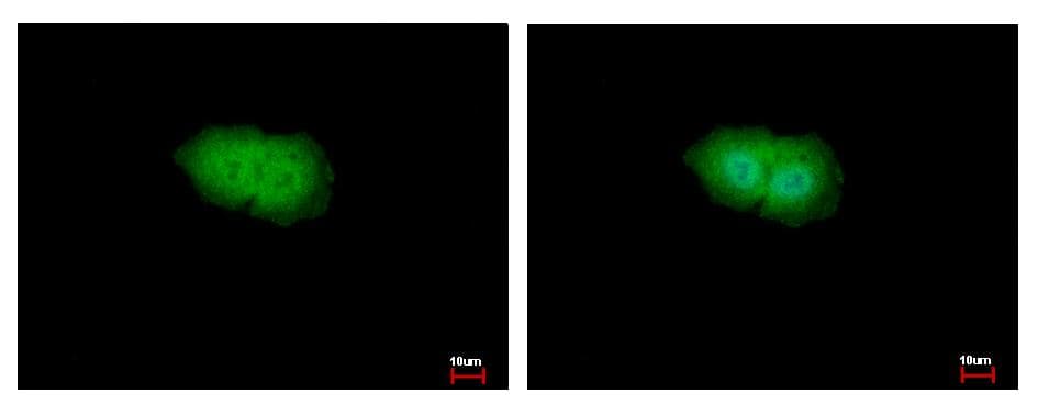 RPS6KA1 / RSK1 Antibody (aa303-527)