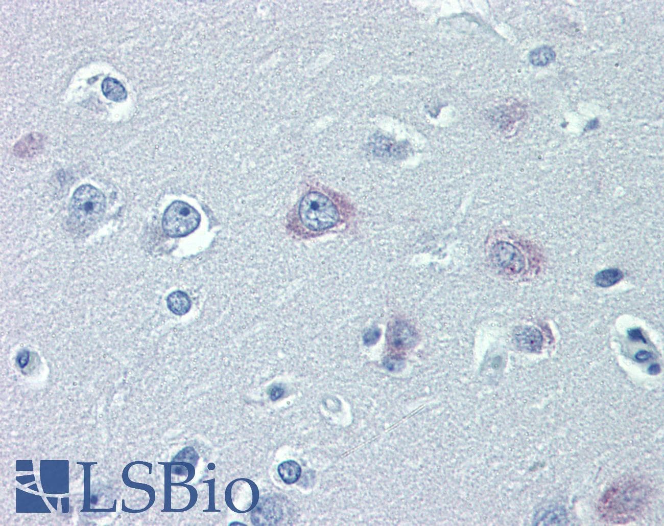 TRPM2 Antibody (aa431-480)