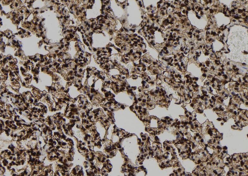 Polyclonal Rabbit anti-Human PPP1R9B / Spinophilin Antibody (IHC, WB)