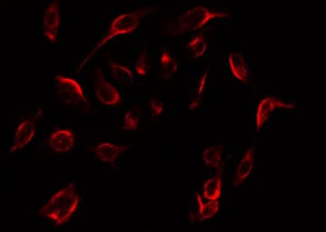 ER Alpha / Estrogen Receptor Antibody (phospho-Ser104)