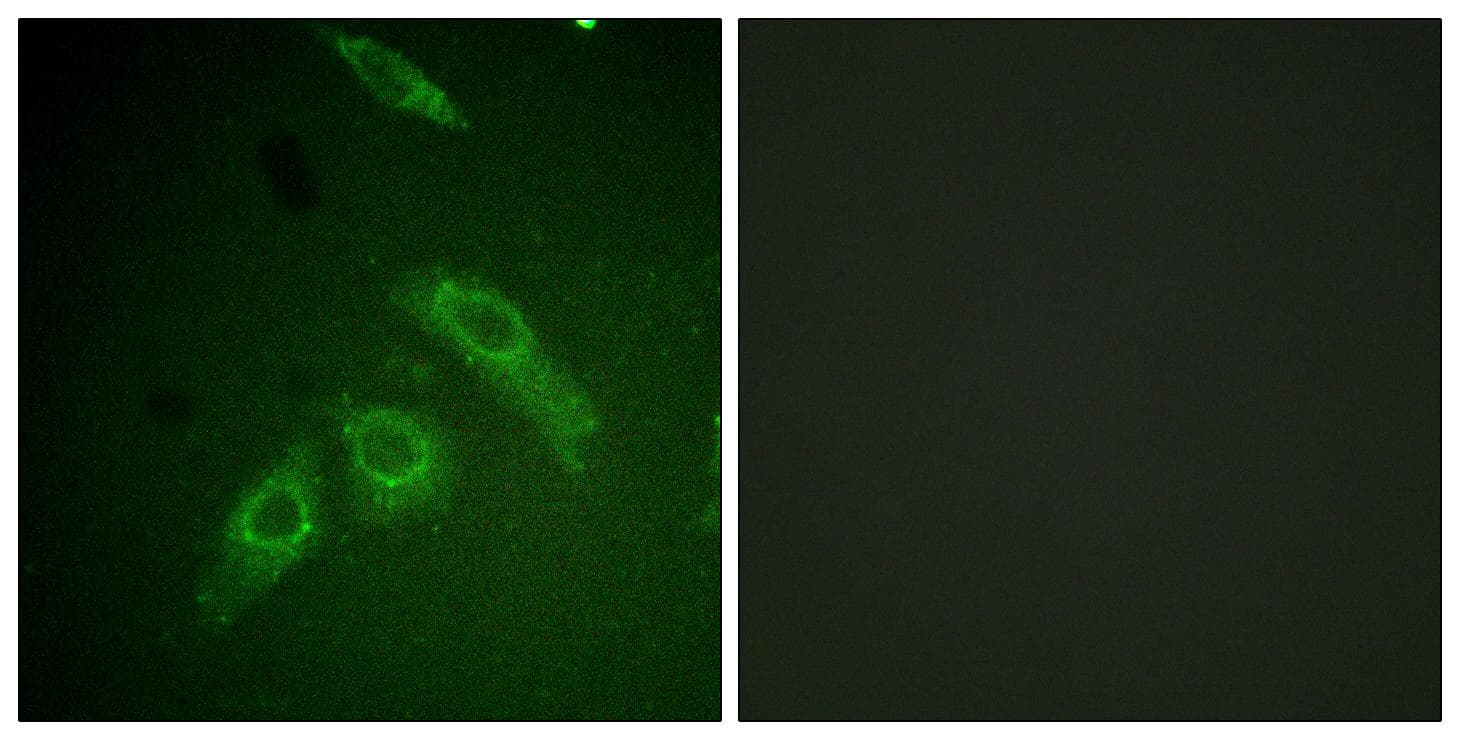 FAK / Focal Adhesion Kinase Antibody (phospho-Ser910)